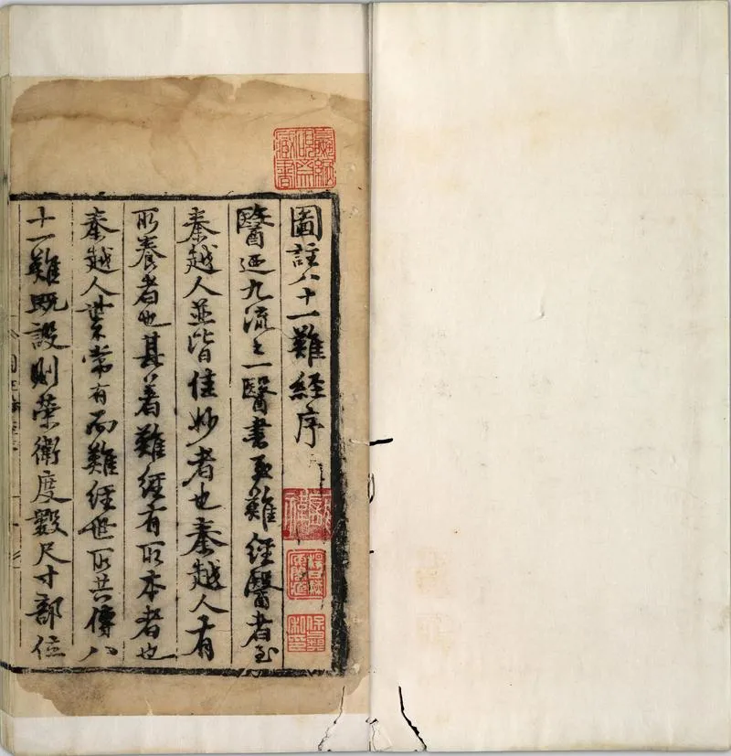 图注八十一难经.八卷.明.张世贤撰.明正德五年扬州吕邦佑刊本_P4.webp