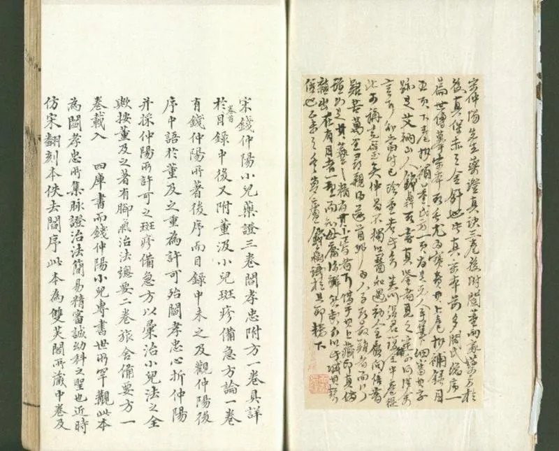 钱氏小儿药证直诀.三卷.宋.钱乙撰.宋刊大字本配补清昭文张氏双芙阁影钞清陈世杰仿宋刊本_P3.webp