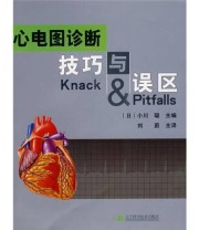 《心电图诊断技巧与误区》  日 小川聪 刘蔚  编 ISBN 9787538153262