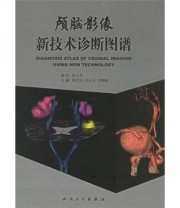 《颅脑影像新技术诊断图谱》 崔世民 只达石 刘梅丽  编 ISBN 9787117074964