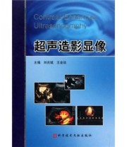《超声造影显像》 刘吉斌 王金锐  著 ISBN 9787502366254