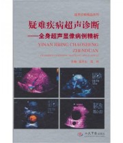《疑难疾病超声诊断 全身超声显病例精析》 富京山 富玮  编 ISBN 9787509132944