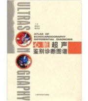 《心脏超声鉴别诊断图谱》 李泉水 杨浣宜  编 ISBN 9787539026022