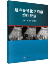 《超声介导化学消融治疗肝癌》 林礼务 薛恩生  著 林礼务 薛恩生  编 ISBN 9787030433749