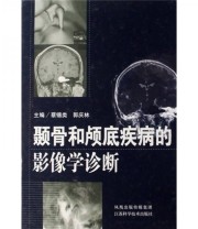 《颞骨和颅底疾病的影像学诊断》 蔡锡类 郭庆林  编 ISBN 9787534556449
