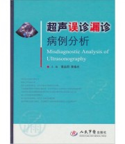 《超声误诊漏诊病例分析》 黄品同 黄福光  编 ISBN 9787509131121