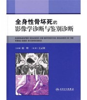 《全身性骨坏死的影像学诊断与鉴别诊断》 屈辉  编 ISBN 9787117118712