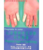 《心血管病体征诊断彩色图谱》  美 富勒（Fowler）  著 王谨 魏玲  译 ISBN 9787543311299