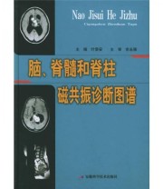 《脑 脊髓和脊柱磁共振诊断图谱》 叶录安  编 ISBN 9787533732127