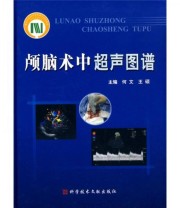 《颅脑术中超声图谱》 何文 王硕  编 ISBN 9787502365318