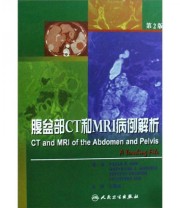《腹盆部CT和MRI病例解析》 Pablo R. Ros  著 王霄英  译 ISBN 9787117109444