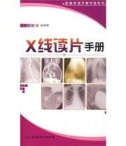 《X线读片手册》 鹿强 侯明辉  编 ISBN 9787801218933