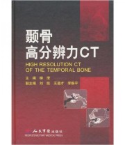 《颞骨高分辨力CT》 柳澄  编 ISBN 9787509125250