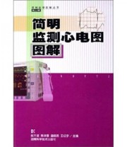 《简明监测心电图图解》 张开滋  著 ISBN 9787535742360